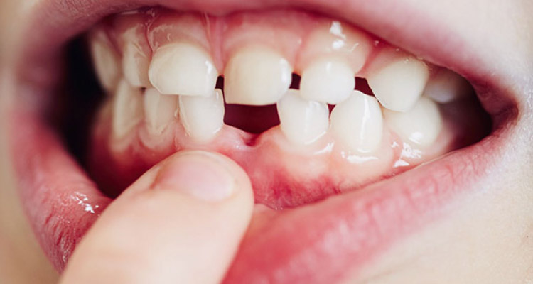 Dentiste