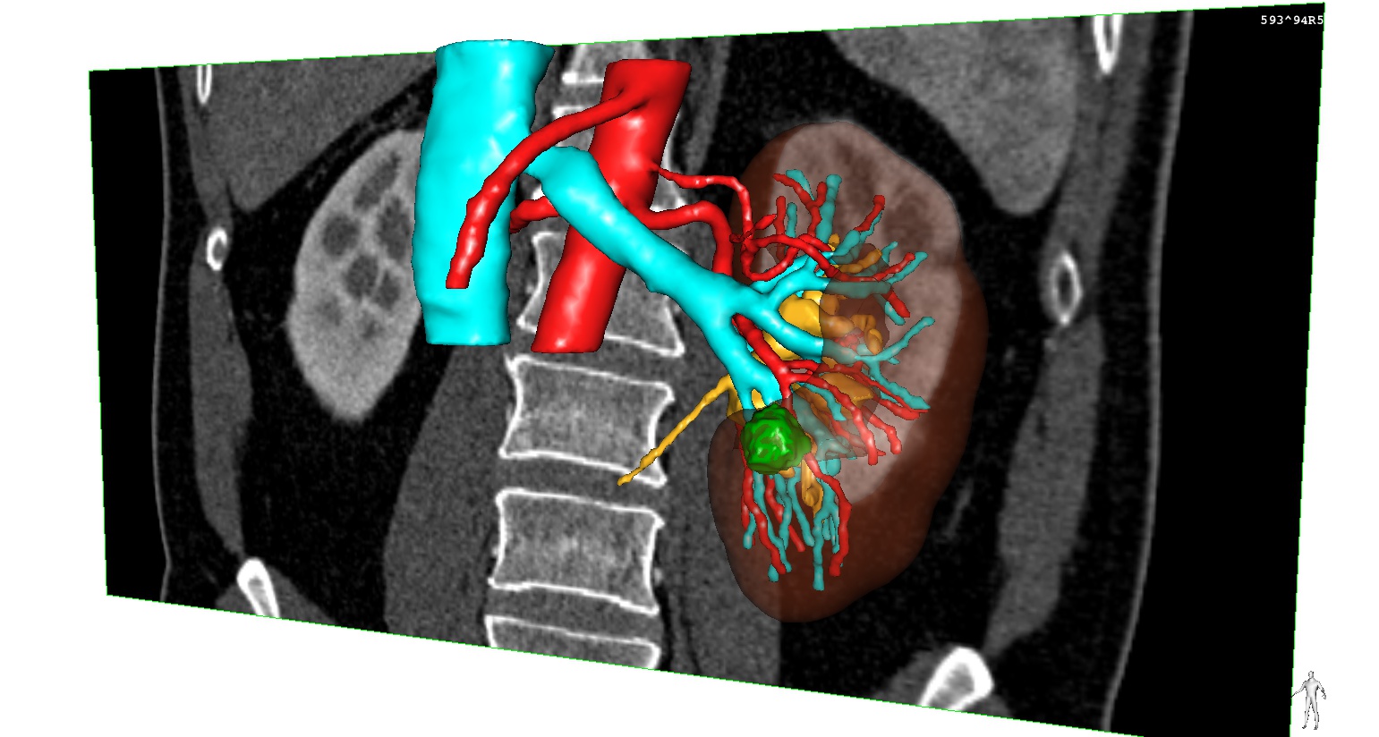 test1-3D-Color-NB.jpg